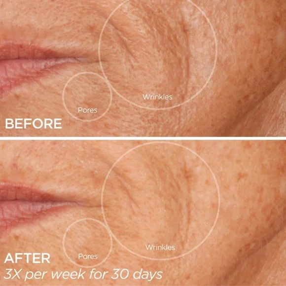 BeautyBio GloPRO Facial Microneedling Tool w Face Eye Body Attachments - Picture 6 of 6